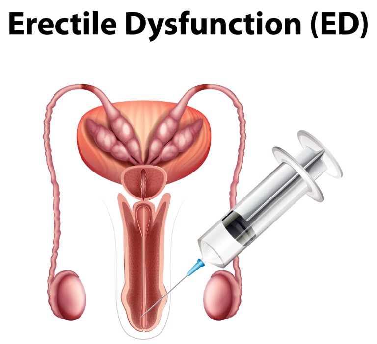 Causes of Erectile Dysfunction in Griffin, GA